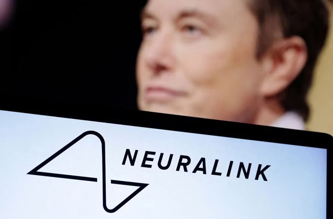  Chip cấy não của Elon Musk sắp được thử nghiệm trên người
